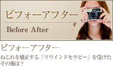 ビフォーアフター