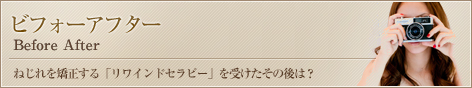 ビフォーアフター